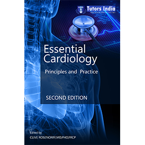 Essential Cardiology-Principles and Practice